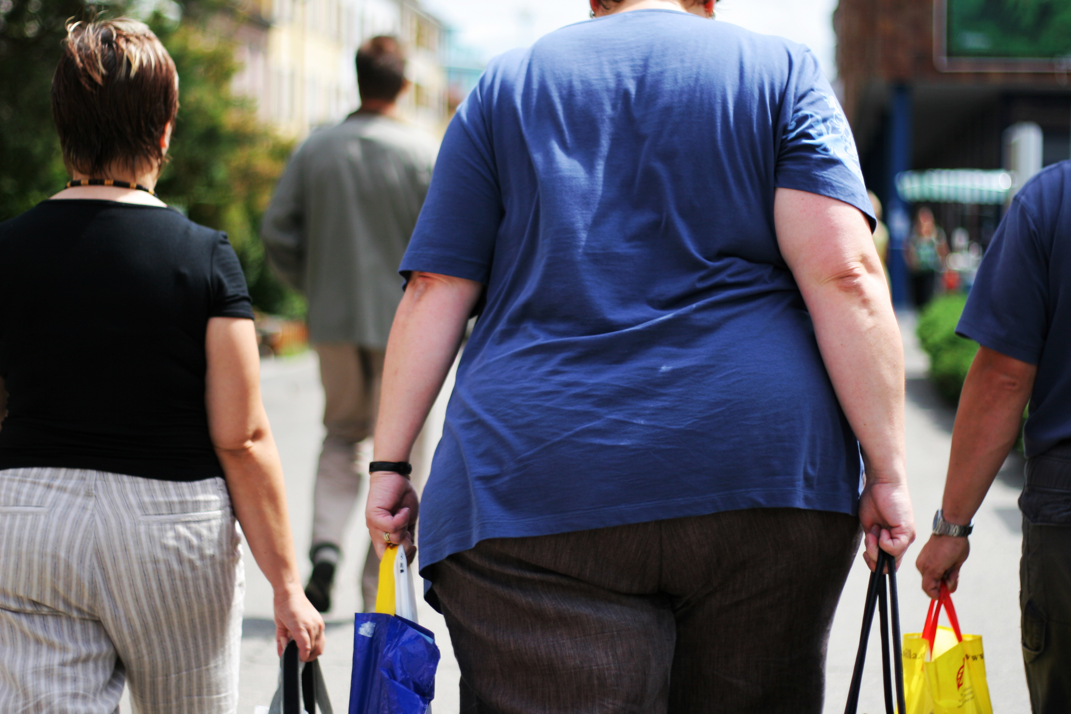 Obesity in the UK